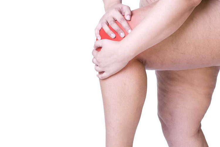 Total Knee Replacement Fact Obesity Puts Patients at Risk