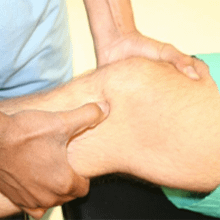 acl-1 acl