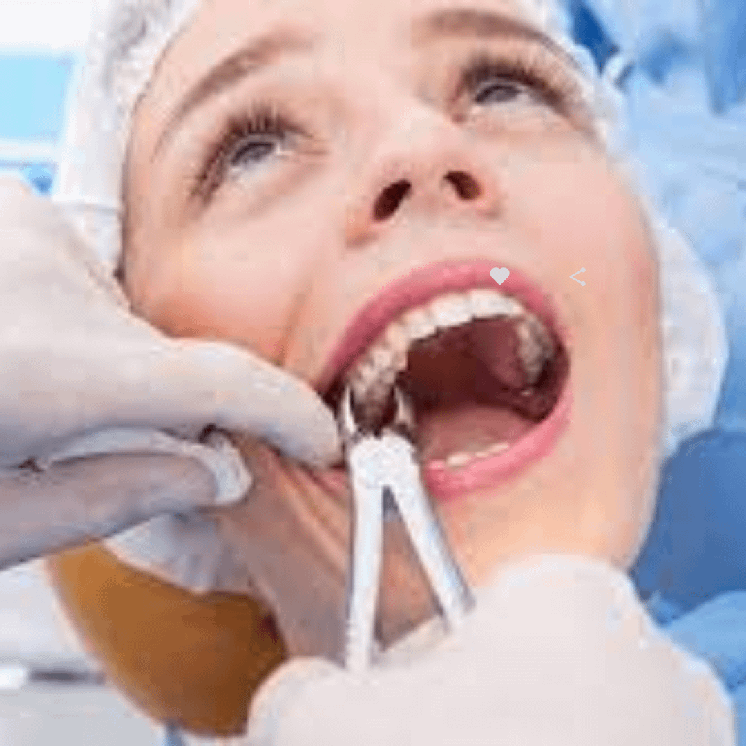 Tooth Extractions in Phoenix