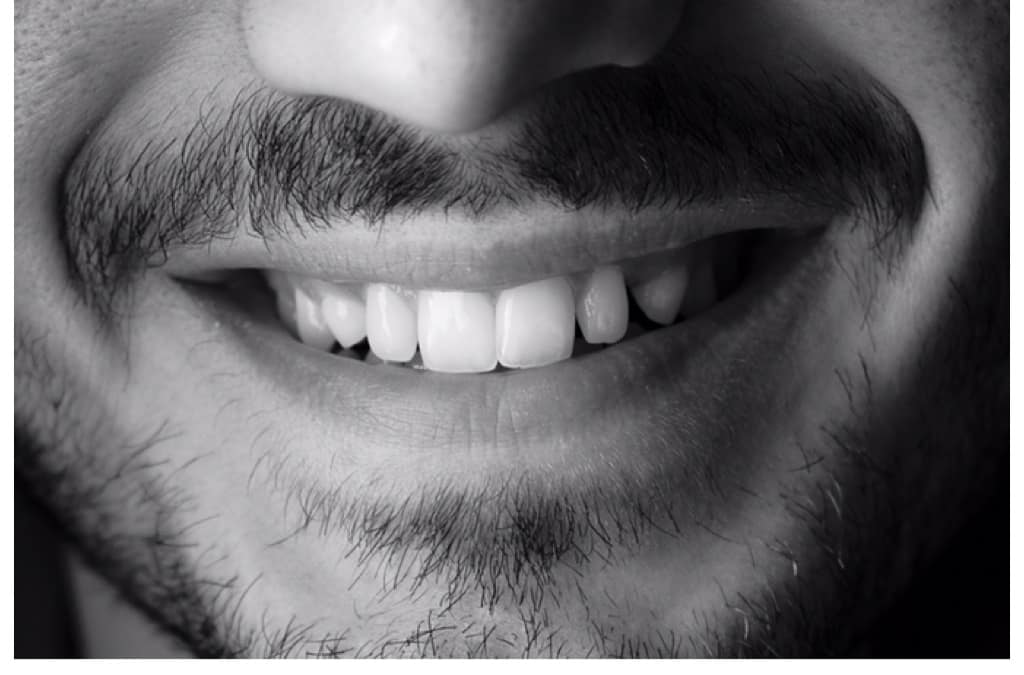 Braces on the road