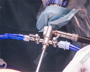 knee arthroscopy tool